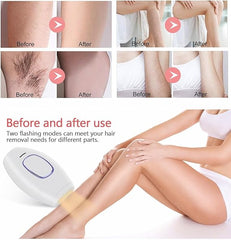 Home Use IPL Beauty Device – Painless Permanent Hair Removal System for Whole Body Nawazia