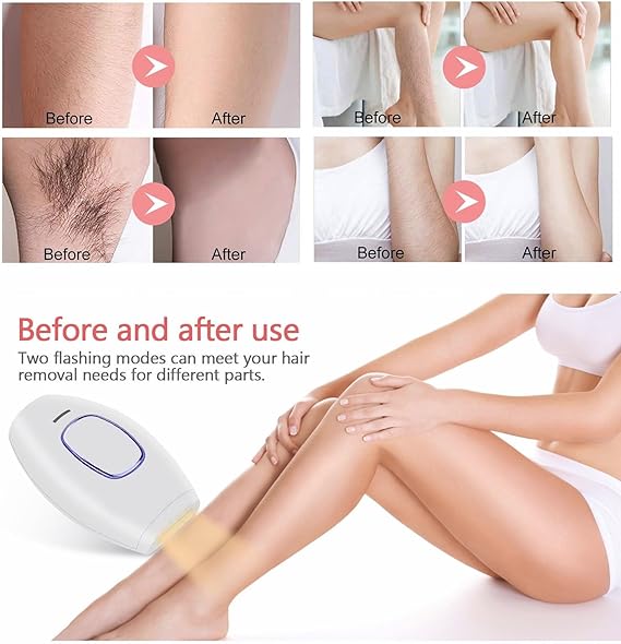 Home Use IPL Beauty Device – Painless Permanent Hair Removal System for Whole Body Nawazia