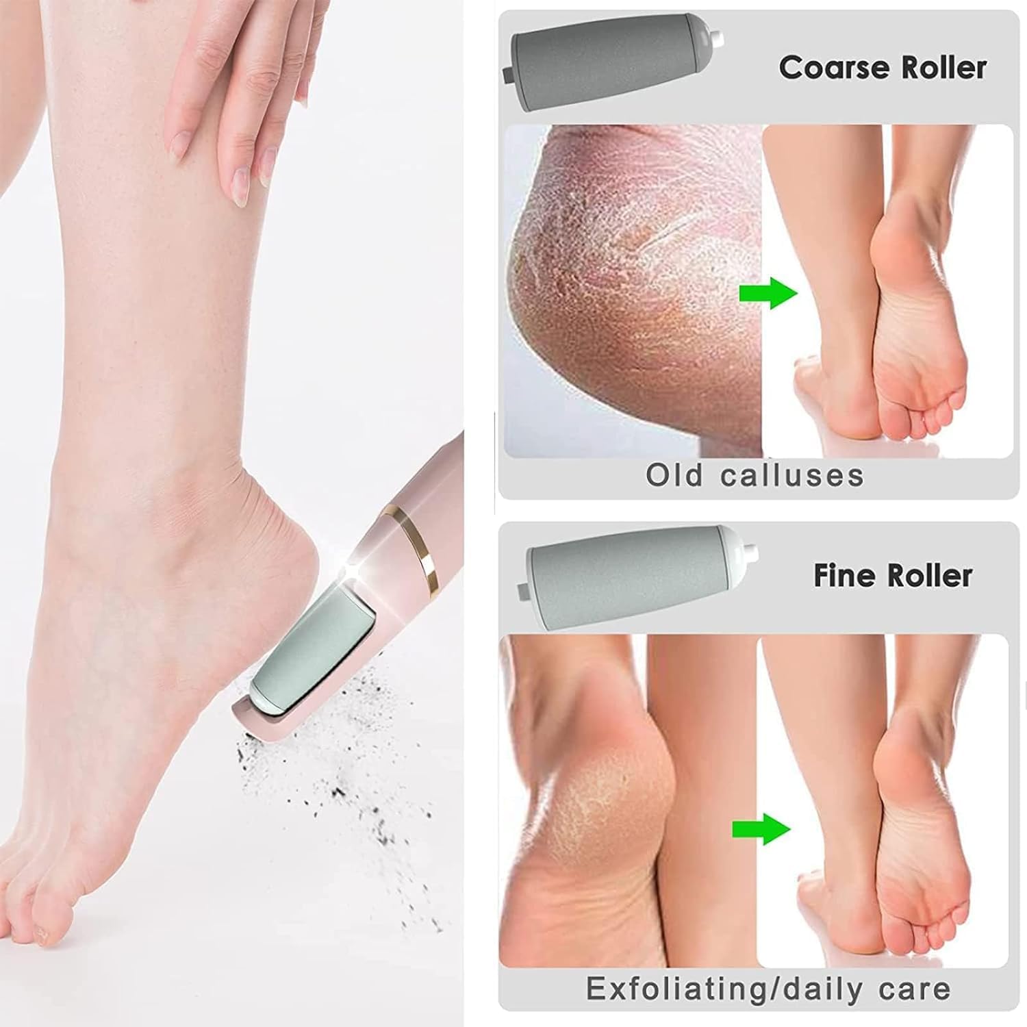 Flawless Pedi | Ultimate Electronic Foot Care Tool for Smooth, Soft Feet Nawazia